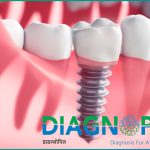 CBC in mumbai, Radiology Scans in mumbai, CT Scan, blood tests, Digital X-Ray, Best Dental Clinic In Mumbai