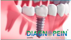 CBC in mumbai, Radiology Scans in mumbai, CT Scan, blood tests, Digital X-Ray, Best Dental Clinic In Mumbai
